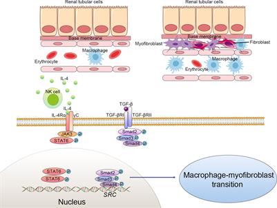 The role of the macrophage-to-myofibroblast transition in renal fibrosis